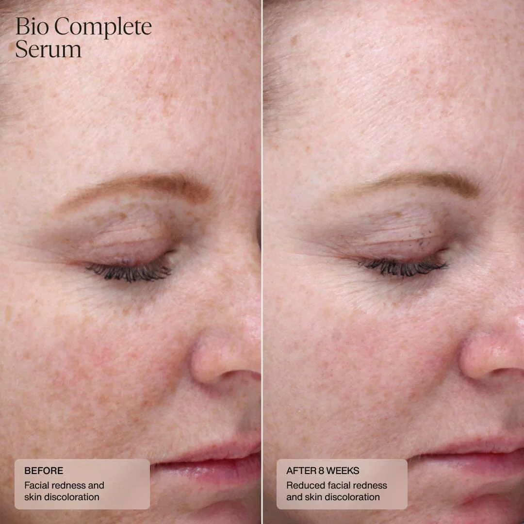 Senté Bio Complete Serum - Image 4